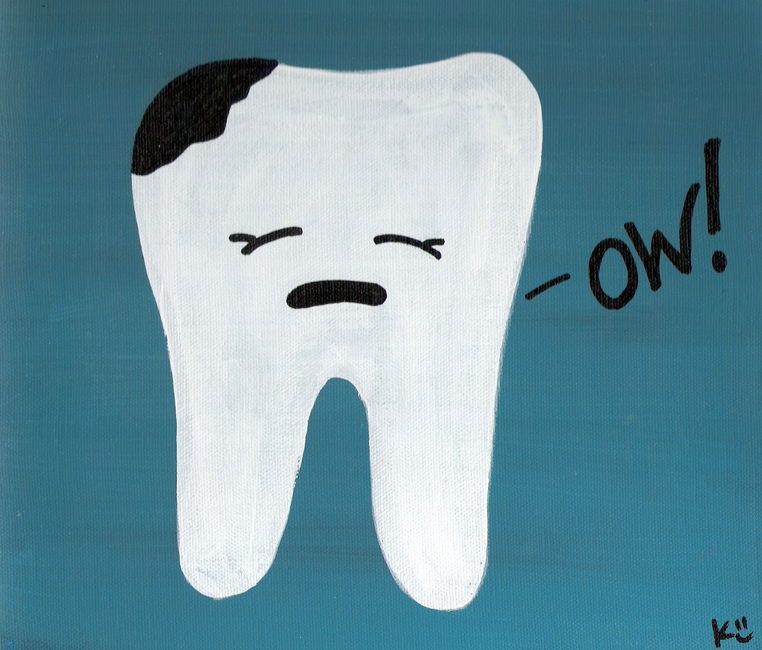 تسوس الأسنان