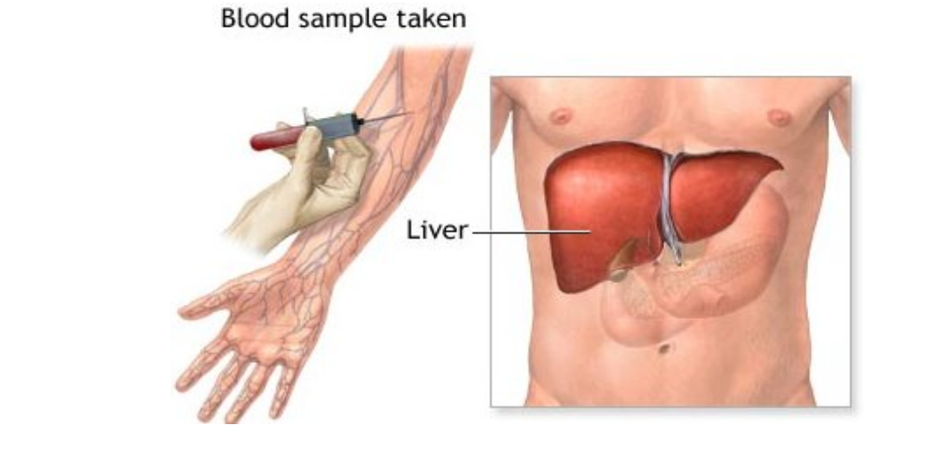 تحليل وظائف الكبد