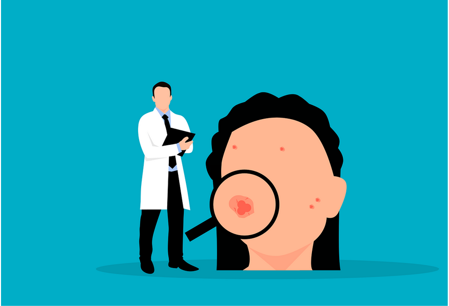 علاج الأمراض الجلدية