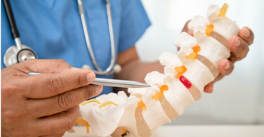 هشاشة العظام