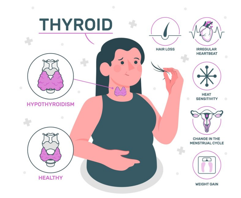 اعراض كسل الغده الدرقية