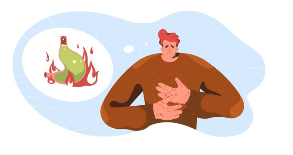 حرقة المعدة/ حرارة المعدة