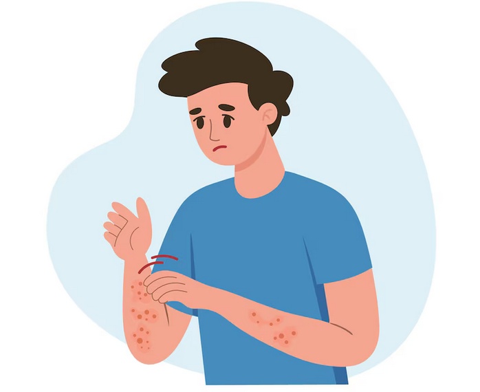 الطفح الجلدي والالتهابات الجلدية